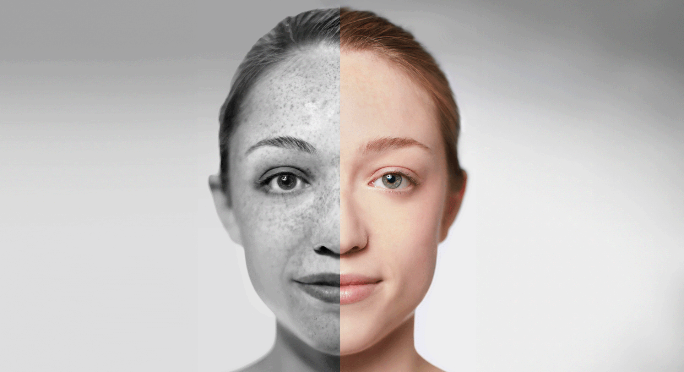 Skin Aging: The causes, effects, and how to slow it – Elysium Health